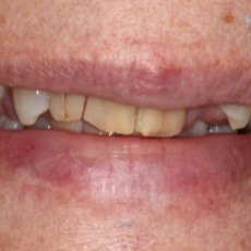 teeth image