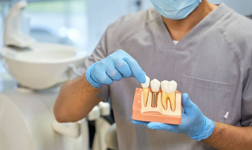 Dental Implants