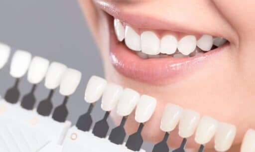 Dental Crowns Falling Out
