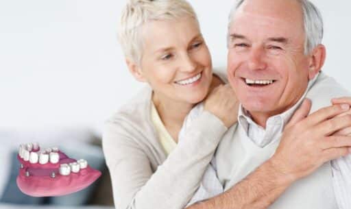 Dentures A Complete Guide