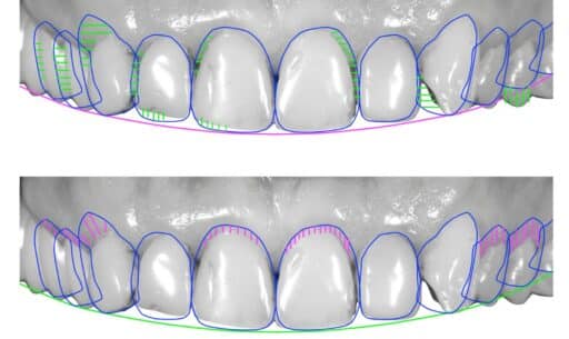How Digital Technology Enhances Signature Smile Design