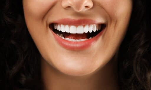 Stains from Teeth Naturally