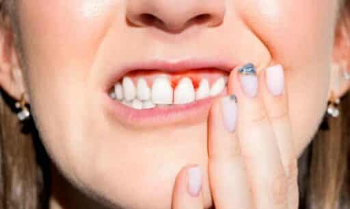How to Fix a Misaligned Jaw Naturally Effective Solutions for Smile