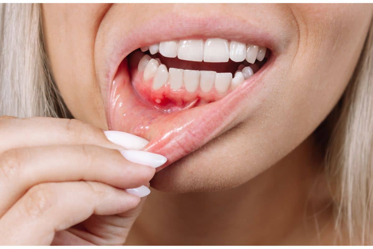 Do You Need Periodontal Treatment? Common Signs of Gum Disease