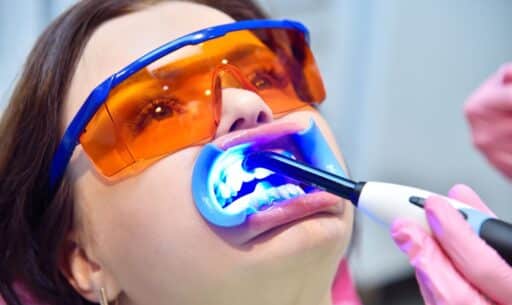 What Causes Tooth Discoloration and How Whitening Can Help