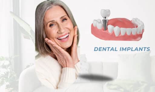 Take to Get Dental Implants