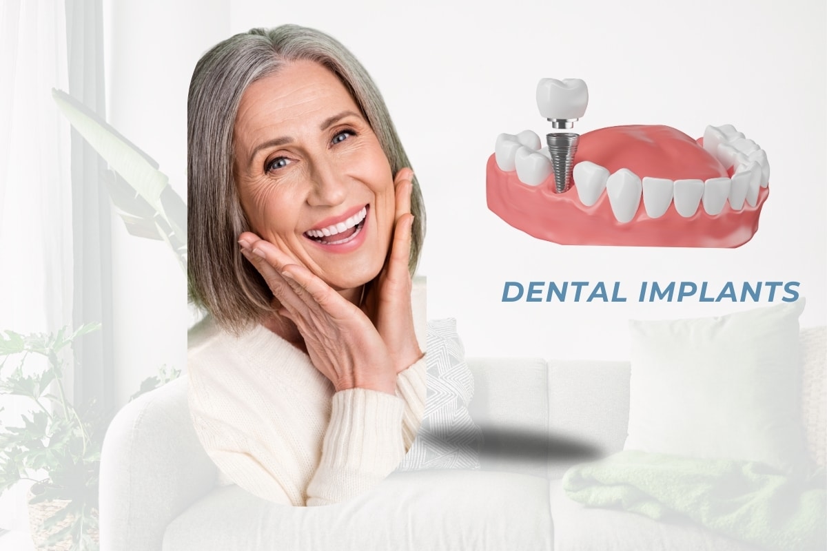 Take to Get Dental Implants