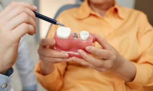 Bone Health After Dental Implants
