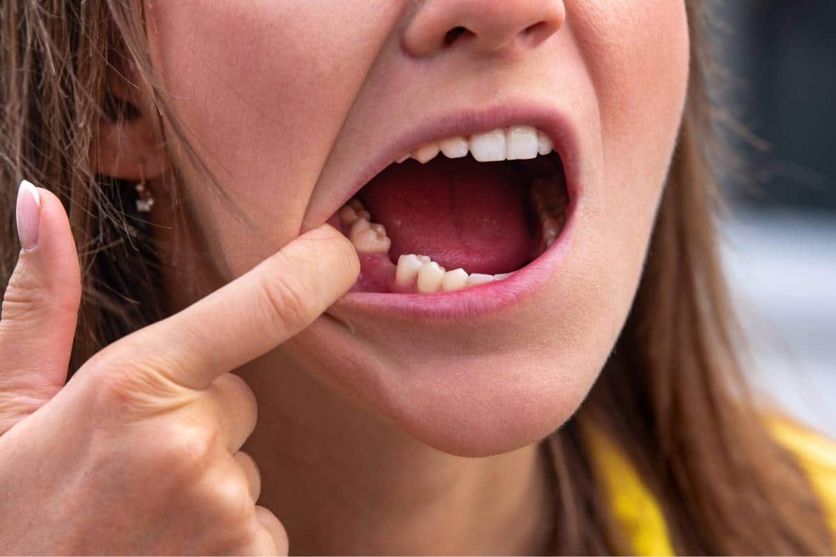 Dental Implant Solutions for Missing Teeth