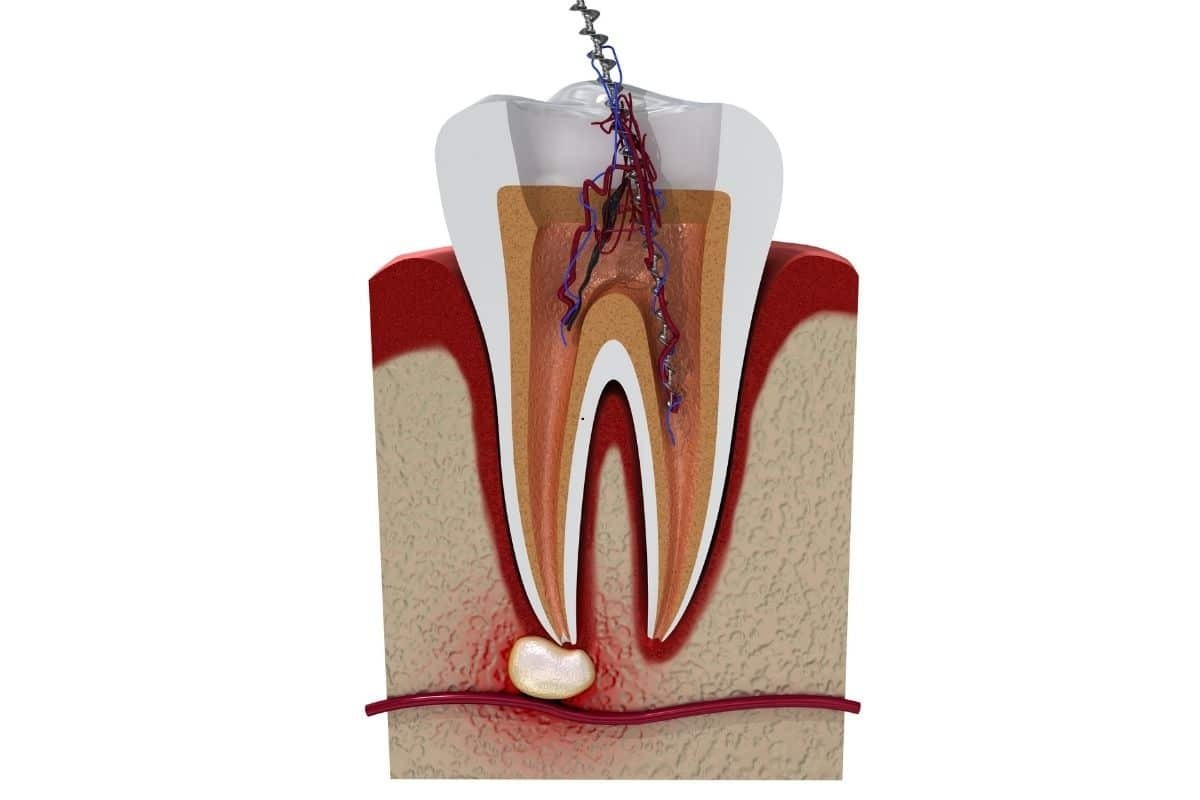 Cross-section diagram of a tooth showing internal anatomy with pulp, nerves, and blood vessels extending to the root.