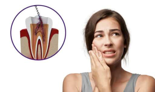 Root Canal Pain Relief & Recovery Tips