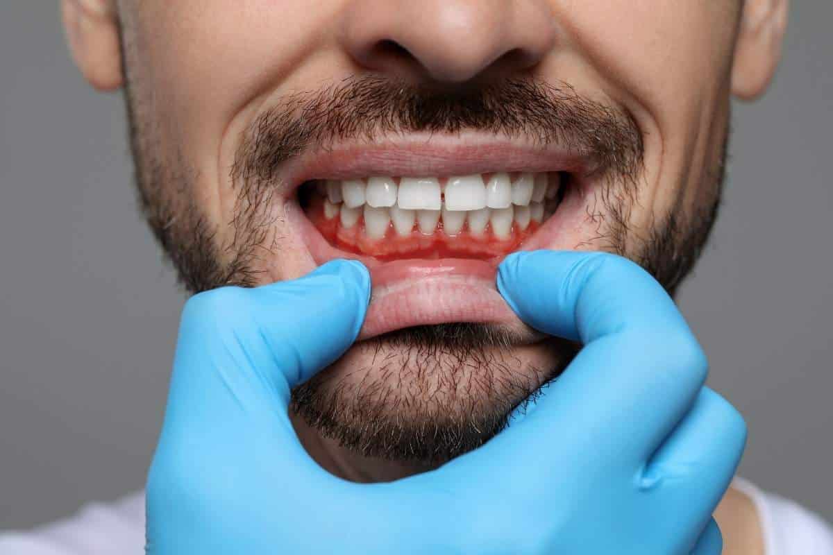 Patient receiving periodontal maintenance cleaning