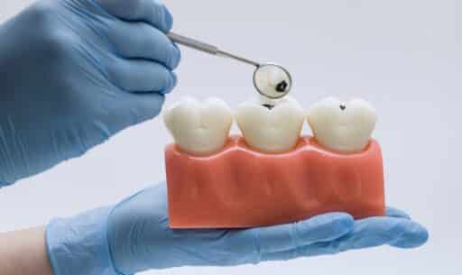 Sweet Danger How Sugar Affects Your Teeth