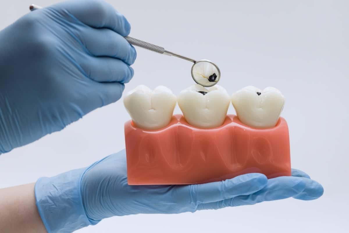 Sweet Danger How Sugar Affects Your Teeth