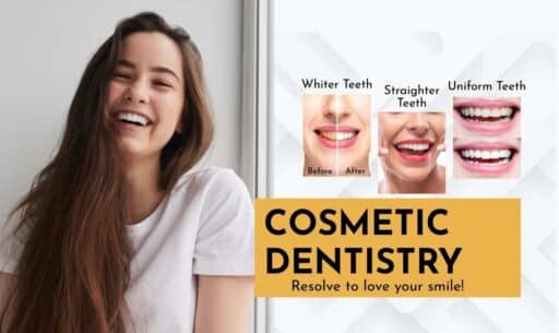 Cosmetic dentistry treatment improving stained and uneven teeth