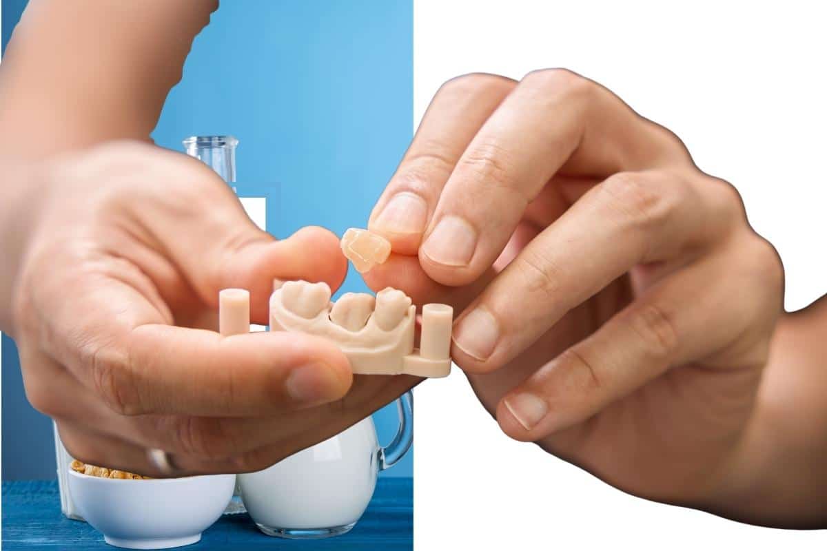 Loose Crown? What to Do & How to Prevent It