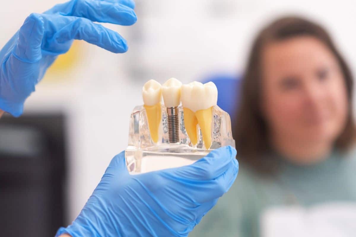 Dental implant model showing natural tooth, implant fixture, and crown held by dentist in blue gloves.