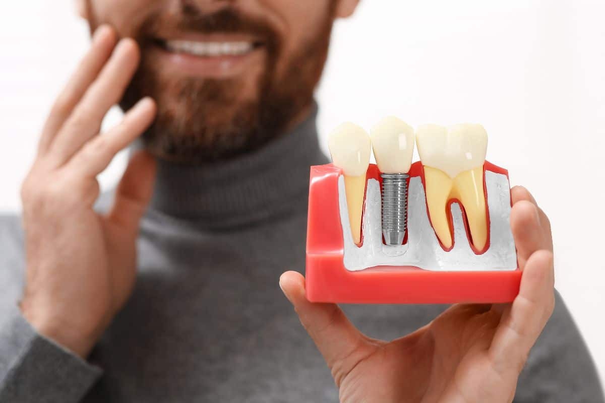 Man holding dental implant model showing tooth replacement procedure with metal screw.