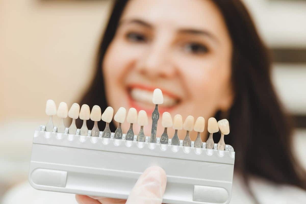Dentist holding tooth shade guide showing various veneer color options for smile enhancement.