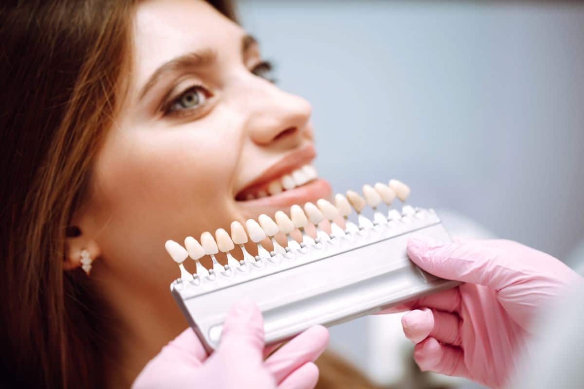 veneers for chipped teeth