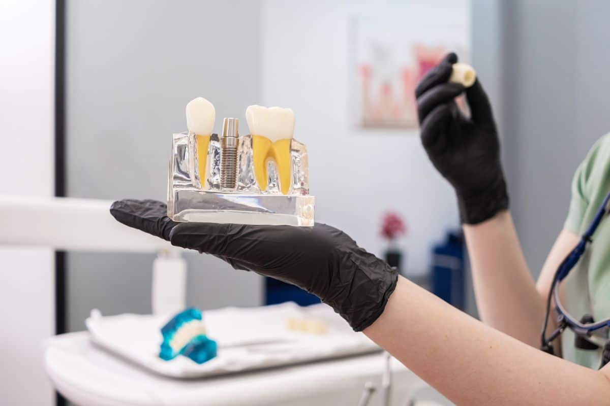dental implant care