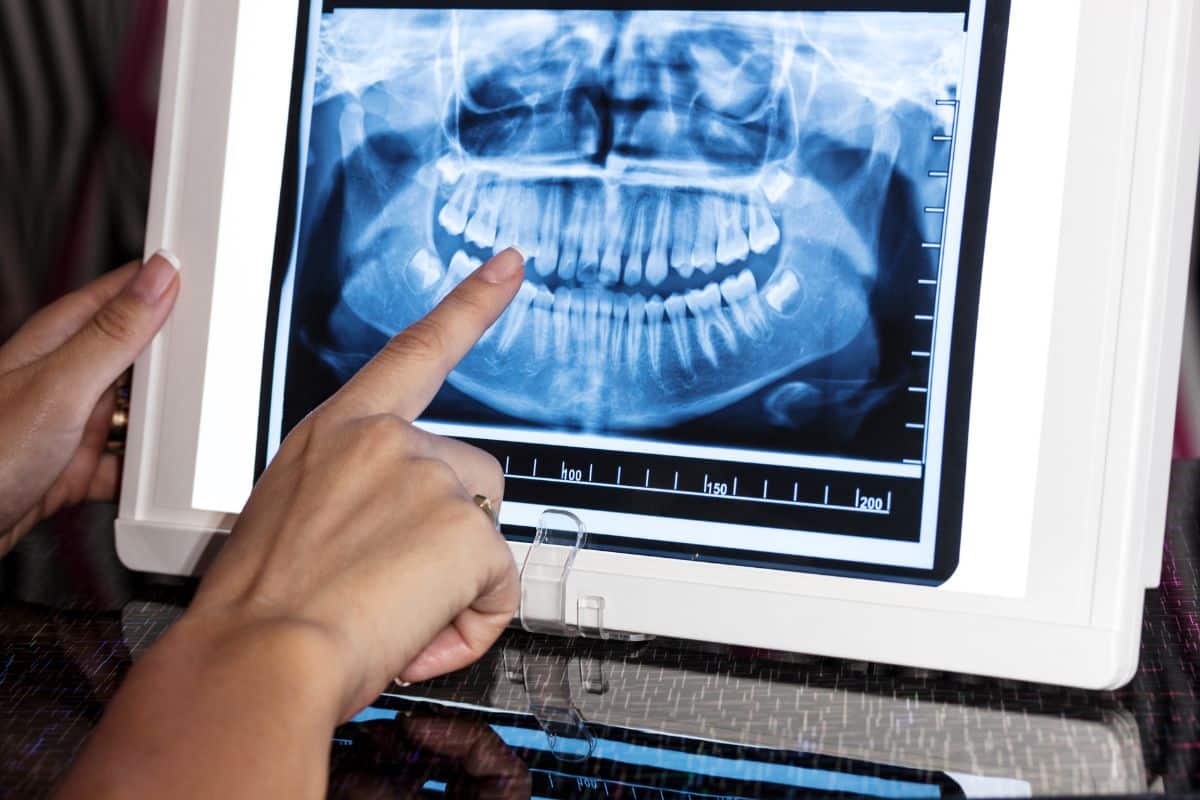 emergency dental x-rays