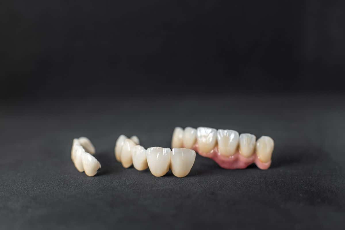 signs you need dental crowns